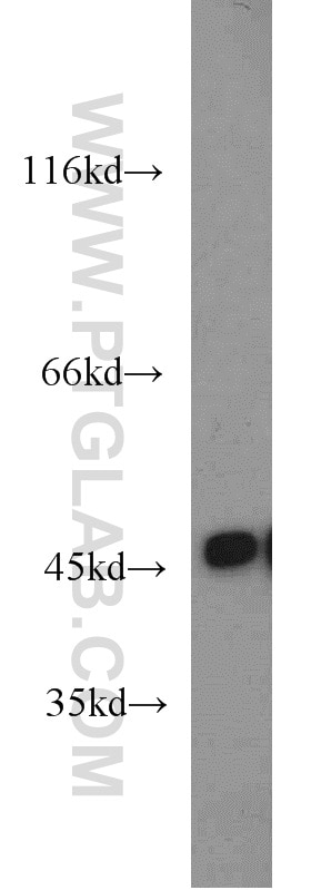 Western Blot (WB) analysis of Jurkat cells using ENO3-specific Polyclonal antibody (55234-1-AP)