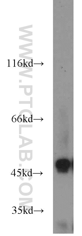 Western Blot (WB) analysis of SH-SY5Y cells using ENO3-specific Polyclonal antibody (55234-1-AP)