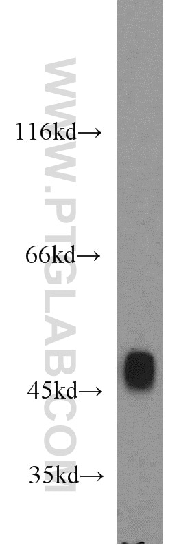 WB analysis of HeLa using 55234-1-AP