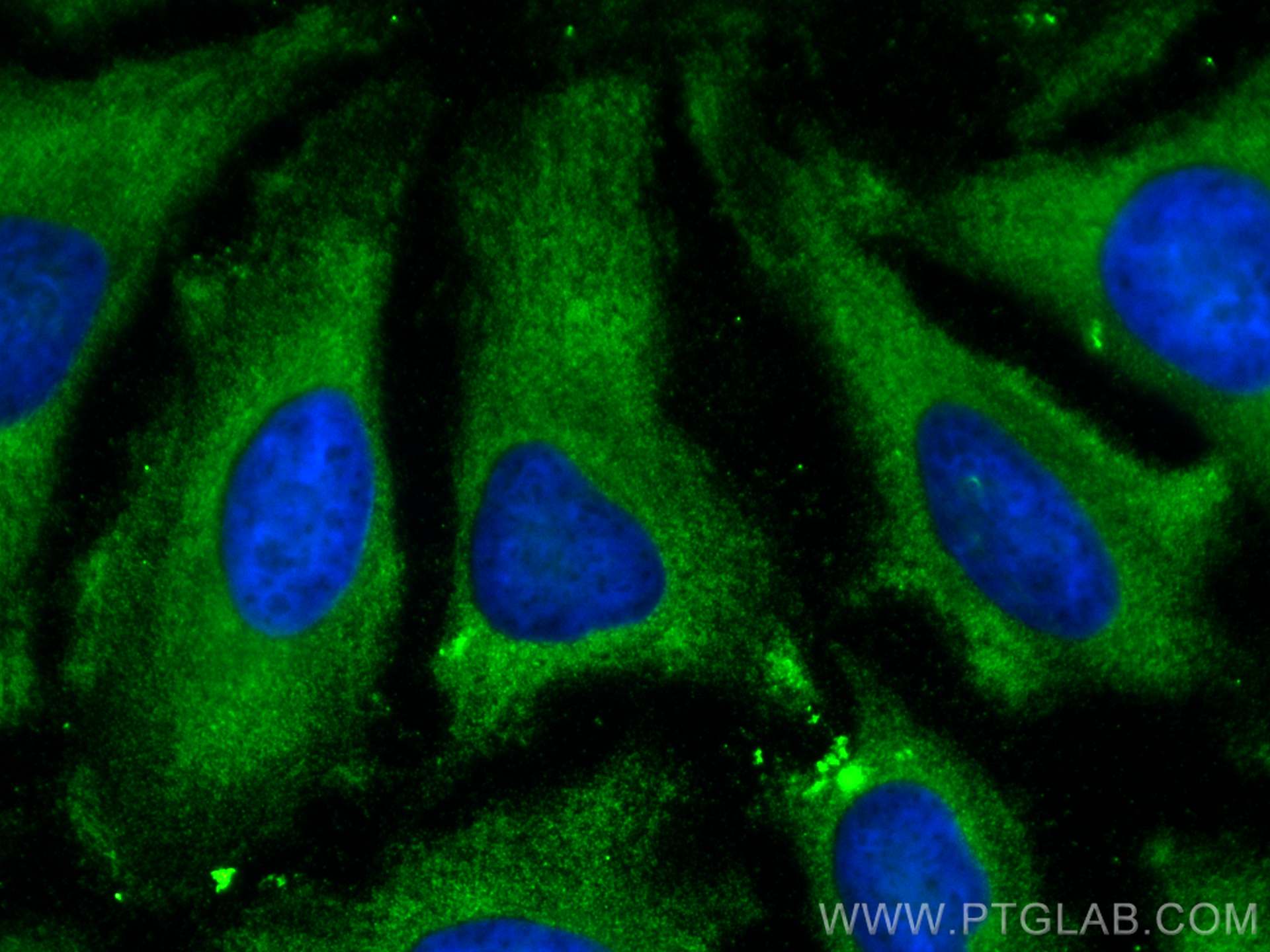 Immunofluorescence (IF) / fluorescent staining of HeLa cells using ENO3 Monoclonal antibody (68147-1-Ig)
