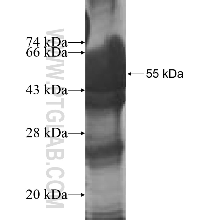 ENO3 fusion protein Ag9613 SDS-PAGE