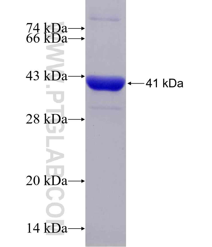 ENO3 fusion protein Ag9642 SDS-PAGE