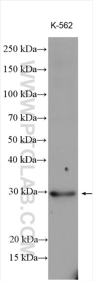 Western Blot (WB) analysis of various lysates using ENOPH1 Polyclonal antibody (11763-1-AP)