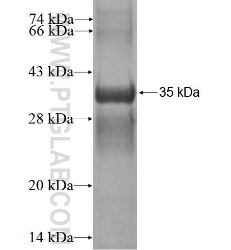 ENOPH1 fusion protein Ag2360 SDS-PAGE