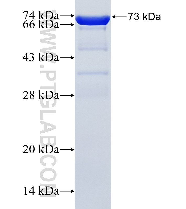 ENOSF1 fusion protein Ag34665 SDS-PAGE