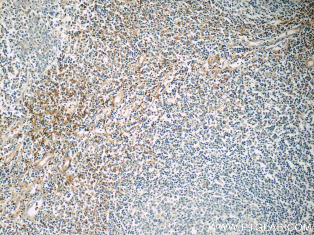 Immunohistochemistry (IHC) staining of human tonsillitis tissue using ENOX1 Polyclonal antibody (23750-1-AP)