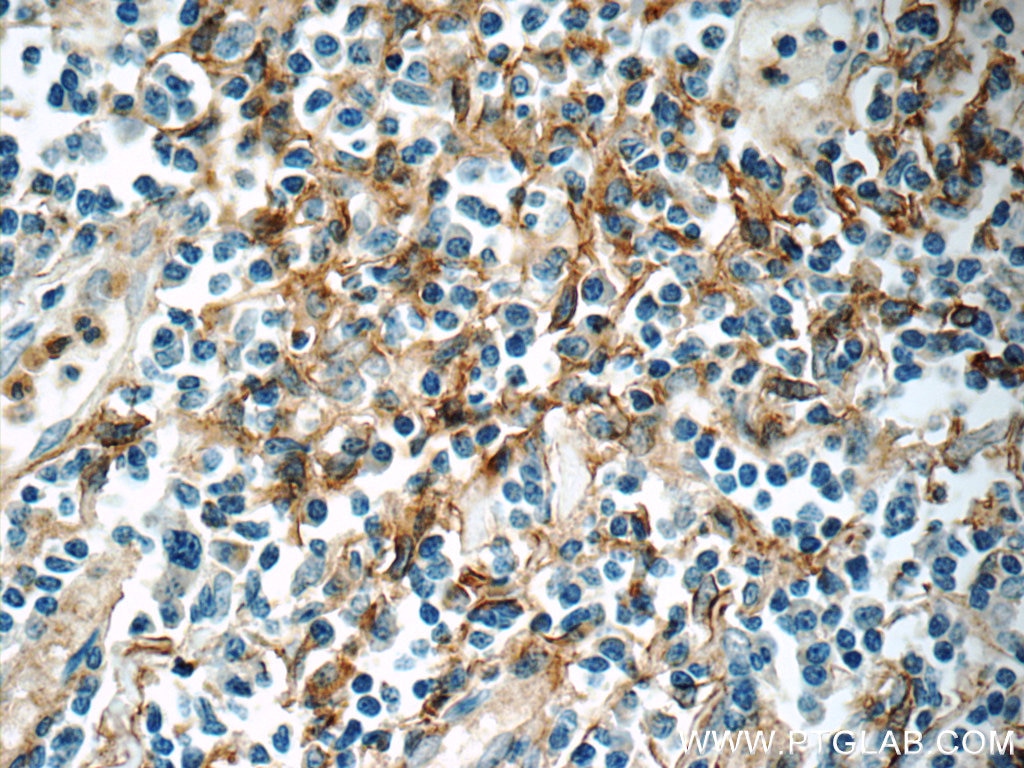 Immunohistochemistry (IHC) staining of human tonsillitis tissue using ENOX1 Polyclonal antibody (23750-1-AP)