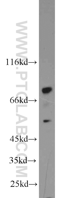 Western Blot (WB) analysis of MCF-7 cells using ENOX1 Polyclonal antibody (23750-1-AP)