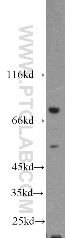 Western Blot (WB) analysis of MCF-7 cells using ENOX1 Polyclonal antibody (23750-1-AP)