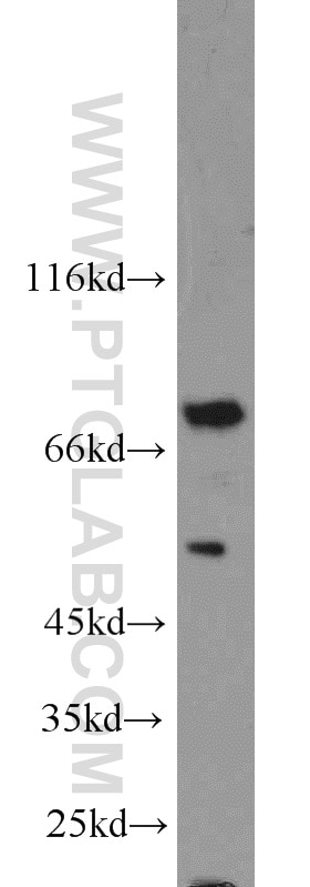 Western Blot (WB) analysis of MCF-7 cells using ENOX1 Polyclonal antibody (23750-1-AP)