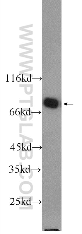 Western Blot (WB) analysis of Jurkat cells using ENOX1 Polyclonal antibody (23750-1-AP)