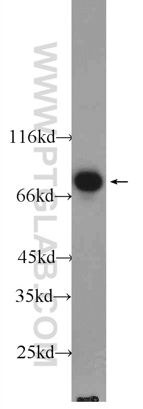 Western Blot (WB) analysis of Jurkat cells using ENOX1 Polyclonal antibody (23750-1-AP)