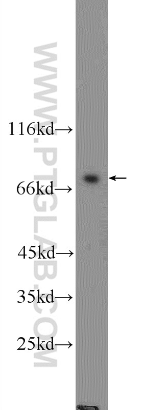 Western Blot (WB) analysis of Raji cells using ENOX1 Polyclonal antibody (23750-1-AP)