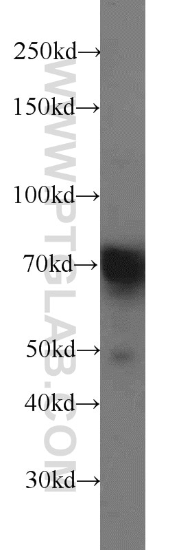 WB analysis of PC-3 using 10423-1-AP