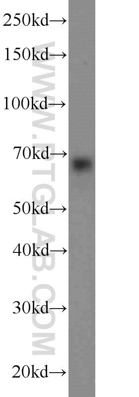 Western Blot (WB) analysis of HeLa cells using ENOX2 Polyclonal antibody (10423-1-AP)