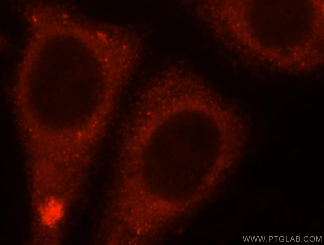 Immunofluorescence (IF) / fluorescent staining of HepG2 cells using ENPEP Polyclonal antibody (17655-1-AP)