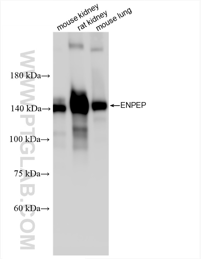 Western Blot (WB) analysis of various lysates using ENPEP Recombinant antibody (85963-1-RR)