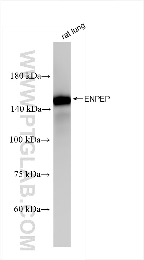 ENPEP