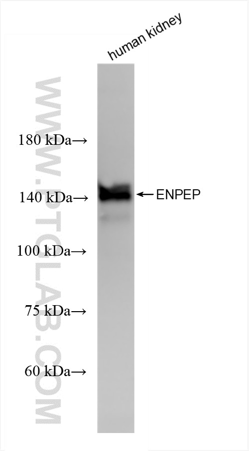 Western Blot (WB) analysis of human kidney tissue using ENPEP Recombinant antibody (85963-1-RR)