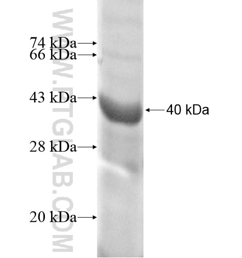 ENPEP fusion protein Ag12411 SDS-PAGE