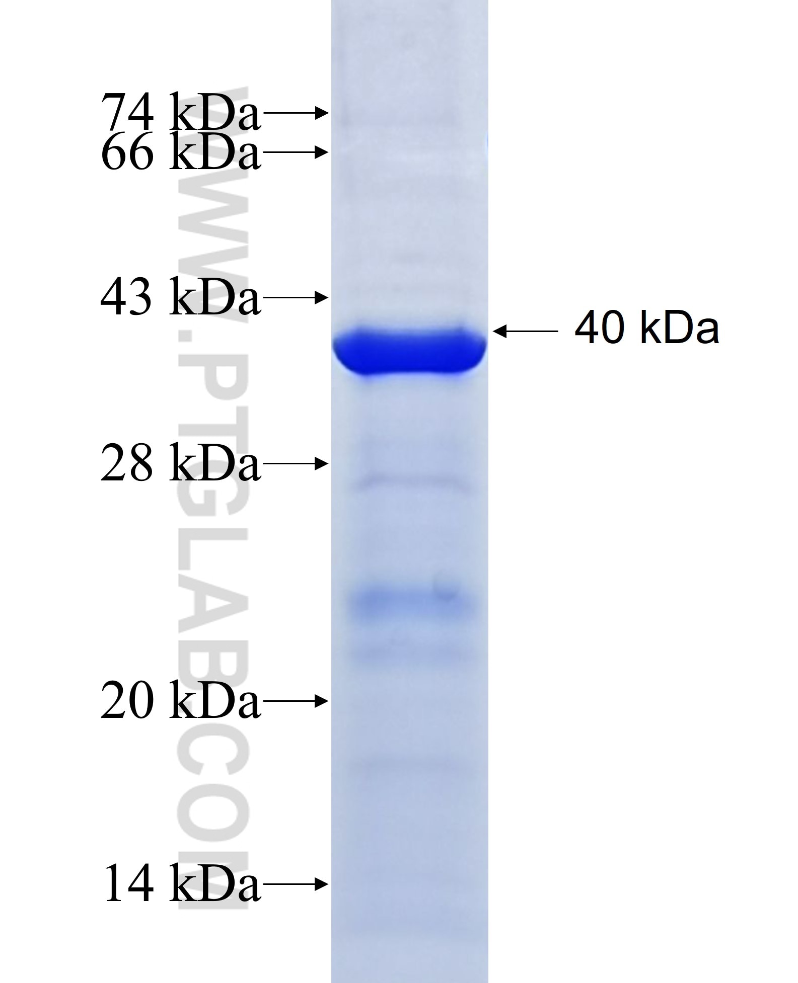 ENPEP fusion protein Ag12411 SDS-PAGE