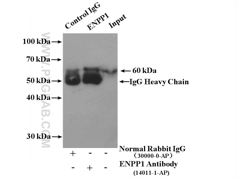 Immunoprecipitation (IP) experiment of Raji cells using ENPP1 Polyclonal antibody (14011-1-AP)