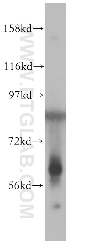 Western Blot (WB) analysis of Raji cells using ENPP1 Polyclonal antibody (14011-1-AP)