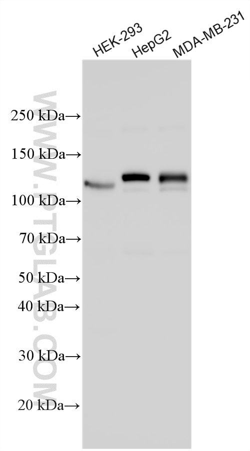 Various lysates were subjected to SDS PAGE followed by western blot with 28886-1-AP (ENPP1 antibody) at dilution of 1:5000 incubated at room temperature for 1.5 hours. Western Blot (WB) analysis of various lysates using ENPP1 Polyclonal antibody (28886-1-AP)