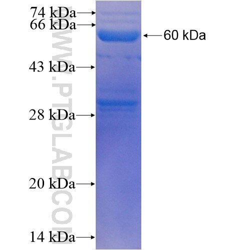 ENPP1 fusion protein Ag5117 SDS-PAGE