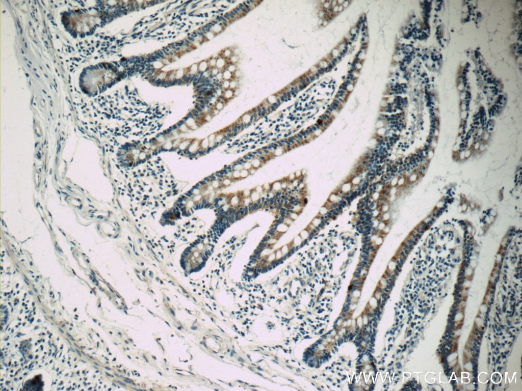 Immunohistochemistry (IHC) staining of human small intestine tissue using Autotaxin Polyclonal antibody (14243-1-AP)