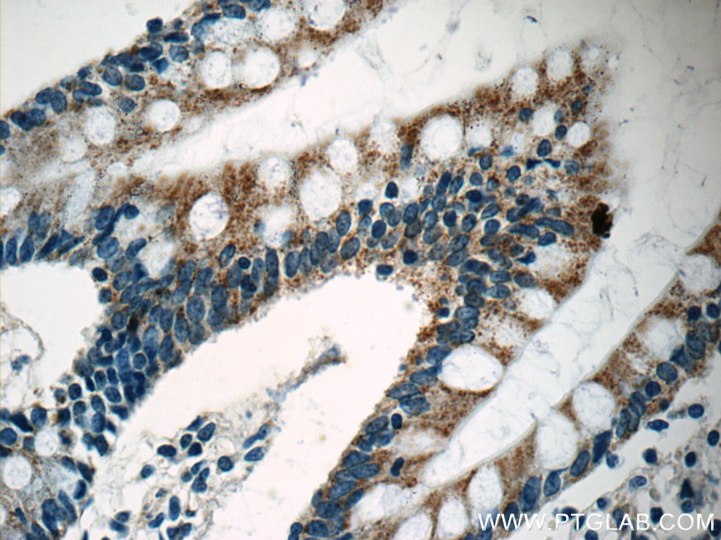 Immunohistochemistry (IHC) staining of human small intestine tissue using Autotaxin Polyclonal antibody (14243-1-AP)