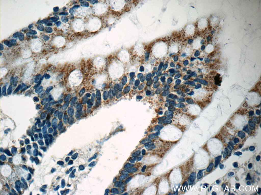 IHC staining of human small intestine using 14243-1-AP