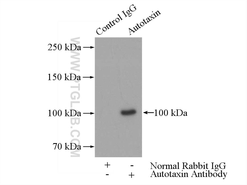 Immunoprecipitation (IP) experiment of mouse brain tissue using Autotaxin Polyclonal antibody (14243-1-AP)