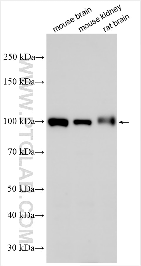 Western Blot (WB) analysis of various lysates using Autotaxin Polyclonal antibody (14243-1-AP)