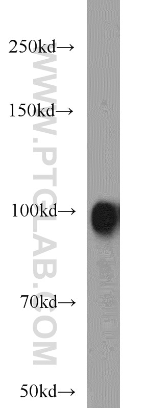 Autotaxin