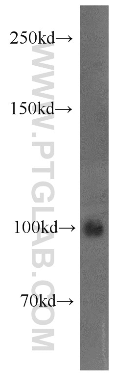 Western Blot (WB) analysis of human placenta tissue using Autotaxin Polyclonal antibody (14243-1-AP)