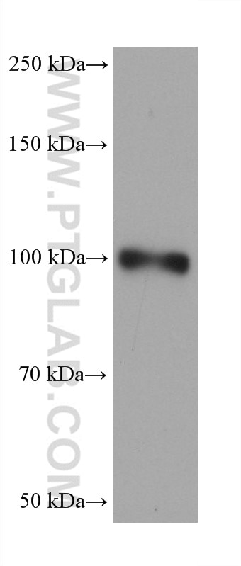 Western Blot (WB) analysis of HuH-7 cells using ENPP2 Monoclonal antibody (68724-1-Ig)