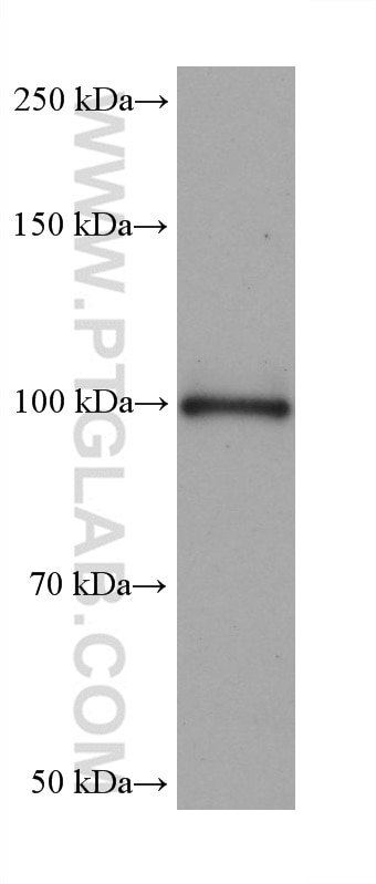 Western Blot (WB) analysis of U-87 MG cells using ENPP2 Monoclonal antibody (68724-1-Ig)