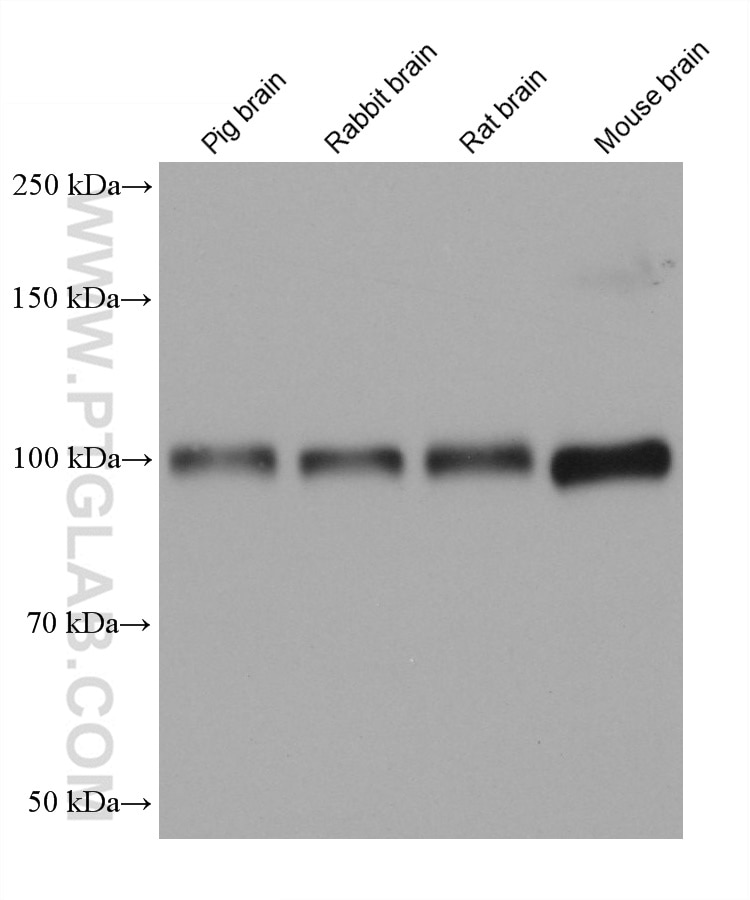 Western Blot (WB) analysis of various lysates using ENPP2 Monoclonal antibody (68724-1-Ig)