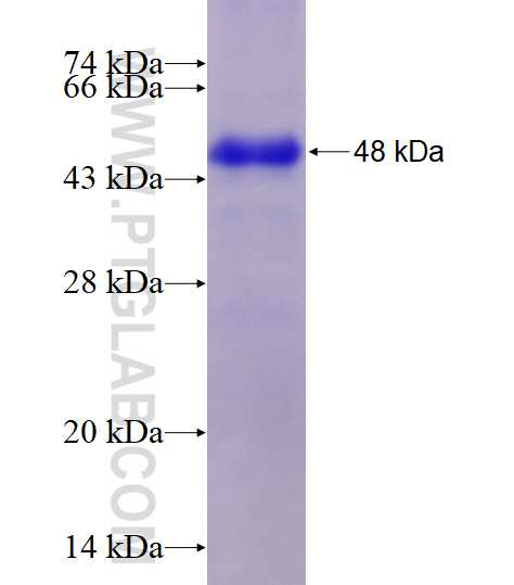 ENPP2 fusion protein Ag5499 SDS-PAGE