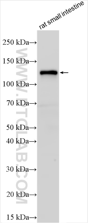 ENPP3