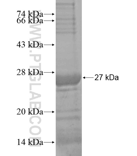 ENPP3 fusion protein Ag18892 SDS-PAGE