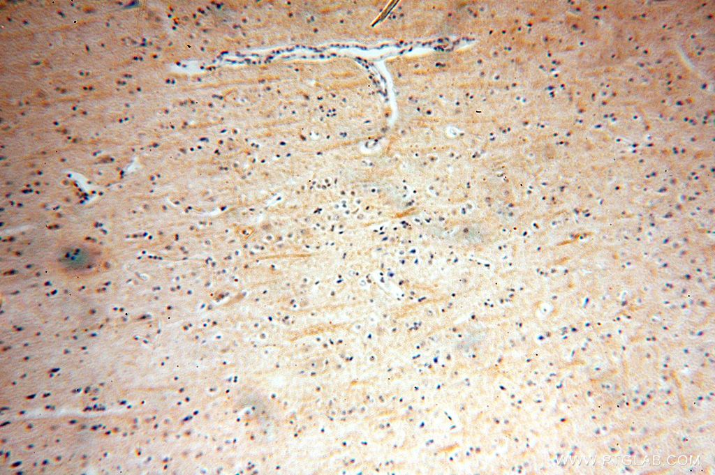 Immunohistochemistry (IHC) staining of human brain tissue using ENPP4 Polyclonal antibody (17305-1-AP)