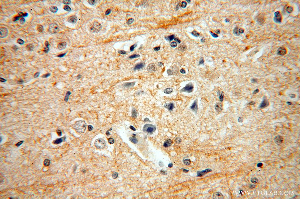 Immunohistochemistry (IHC) staining of human brain tissue using ENPP4 Polyclonal antibody (17305-1-AP)