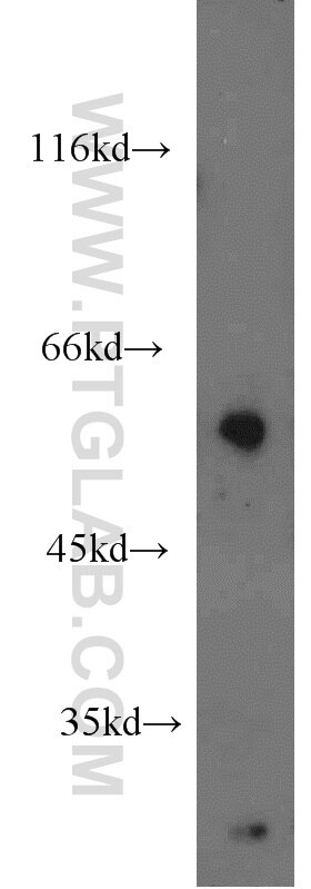 Western Blot (WB) analysis of HL-60 cells using ENPP4 Polyclonal antibody (17305-1-AP)