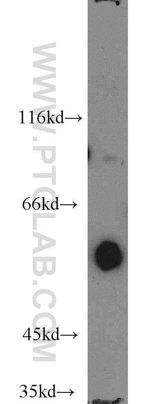 Western Blot (WB) analysis of HL-60 cells using ENPP4 Polyclonal antibody (17305-1-AP)