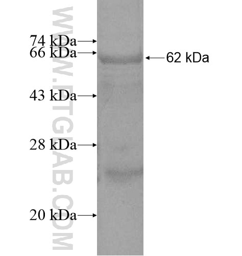 ENPP4 fusion protein Ag11192 SDS-PAGE