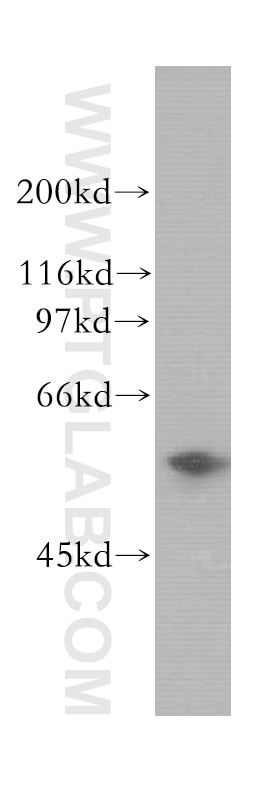 Western Blot (WB) analysis of MCF-7 cells using ENPP5 Polyclonal antibody (12778-1-AP)