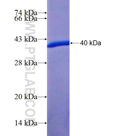 ENPP5 fusion protein Ag25140 SDS-PAGE