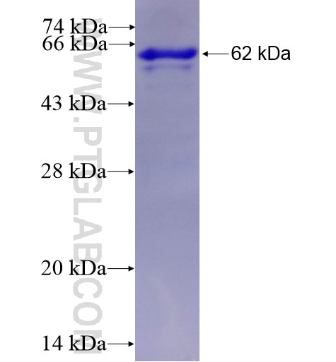 ENPP5 fusion protein Ag3478 SDS-PAGE